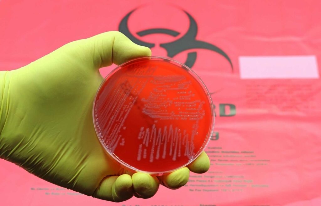 Gloved hand holding a petri dish with bacterial culture illustrating bloodborne pathogen safety.